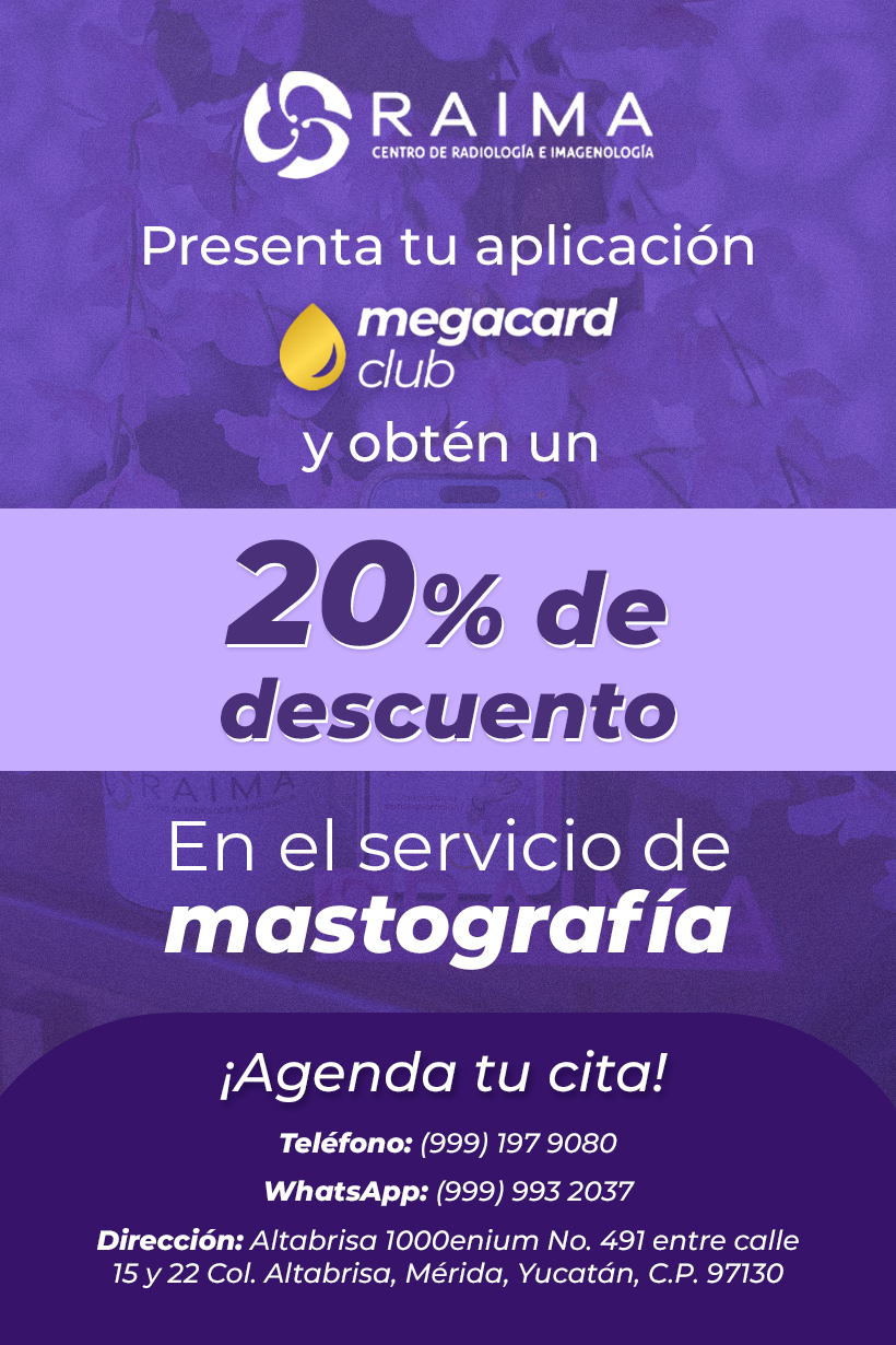 Promoción Los Trompos
